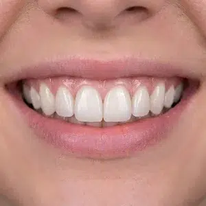 لمینیت دیجیتال کلینیک دندانپزشکی دکتر رضایی