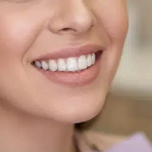 لمینیت دیجیتال کلینیک دندانپزشکی دکتر رضایی