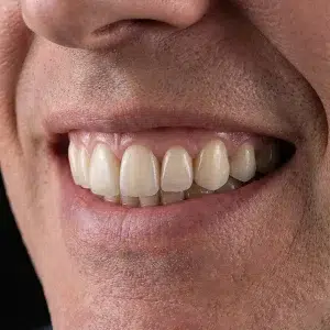 لمینیت دیجیتال کلینیک دندانپزشکی دکتر رضایی