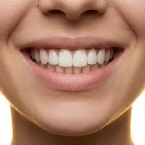 لمینیت دیجیتال کلینیک دندانپزشکی دکتر رضایی