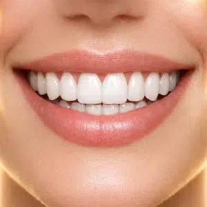 لمینیت دیجیتال کلینیک دندانپزشکی دکتر رضایی