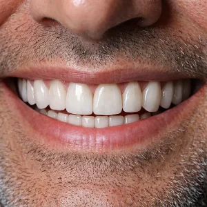 لمینیت دیجیتال کلینیک دندانپزشکی دکتر رضایی